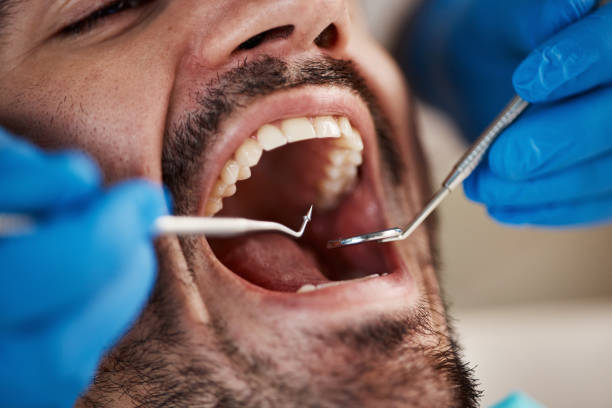Best Emergency Tooth Extraction  in Lake Holiday, IL